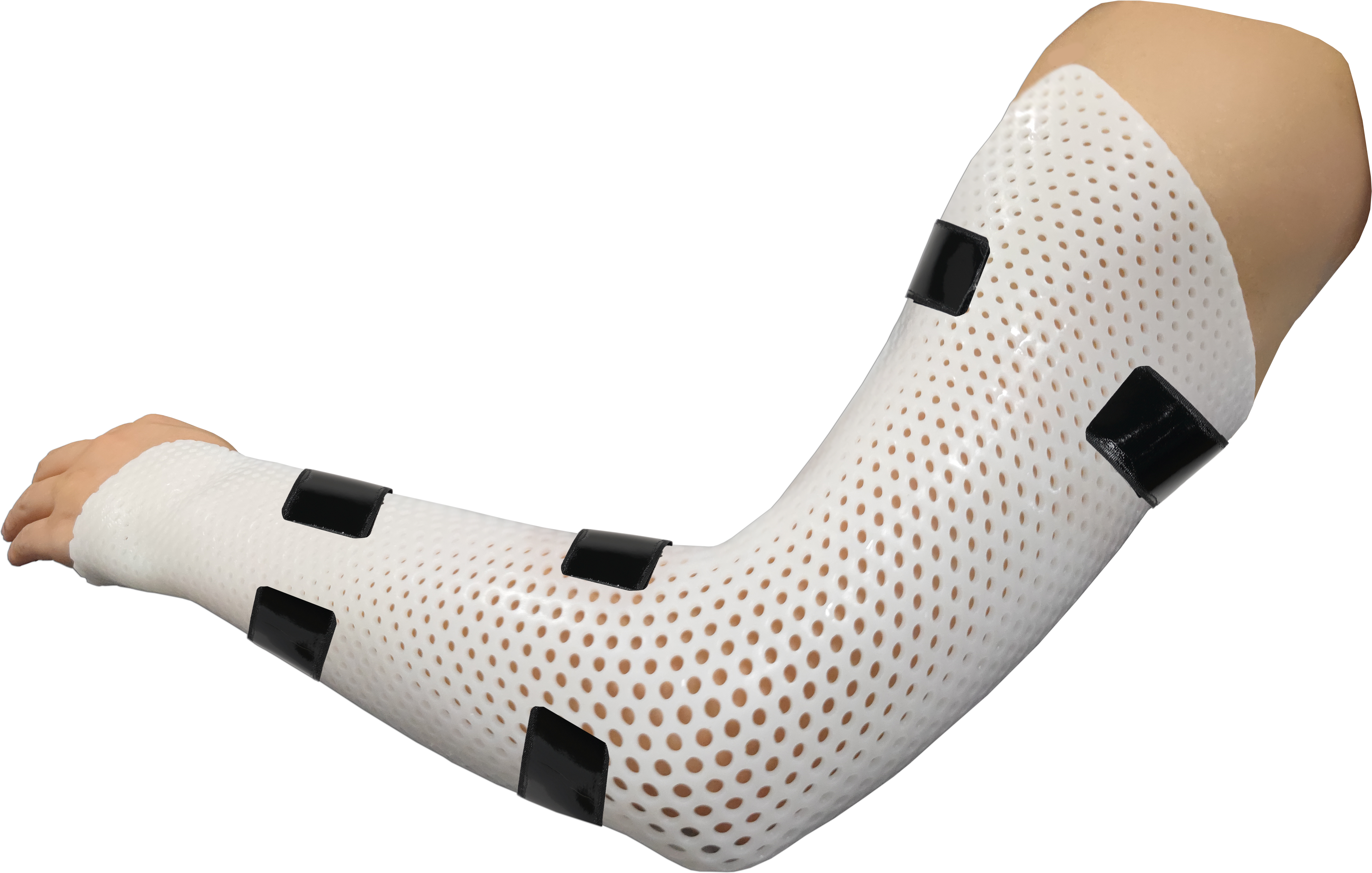 How to make a thermoplastic elbow splint？